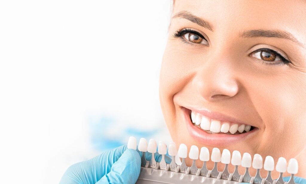 Alegerea culorii fatetei dentare - Estetica Dentara
