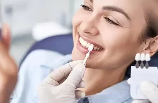 Alegerea fatetelor dentare